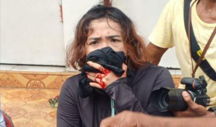 PWI Bojonegoro Angkat Bicara Adanya Wartawan Terluka Saat Liput Aksi Demo 