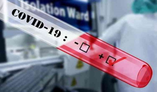Warga Trenggalek Positif Covid-19, Terdeteksi Saat Berlibur