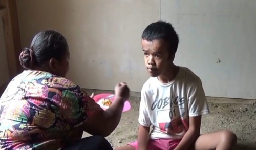 Remaja Penderita Hidrosefalus di Cilacap Butuh Bantuan Slang Baru