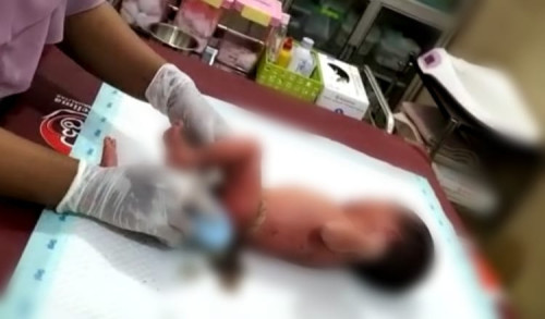 Warga Talango Sumenep Temuka Bayi di dalam Tas, Tali Pusar Penuh Darah dan Pasir