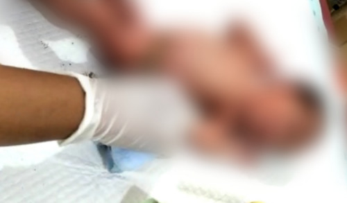 Tali Pusar Bayi yang Ditemukan Warga di Talango Sumenep Diduga Diputus Paksa