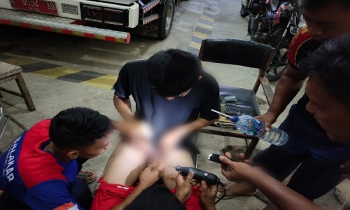 Remaja di Cilacap Pasang Cincin di Kemaluan Tak Bisa Lepas, Damkar Turun Tangan