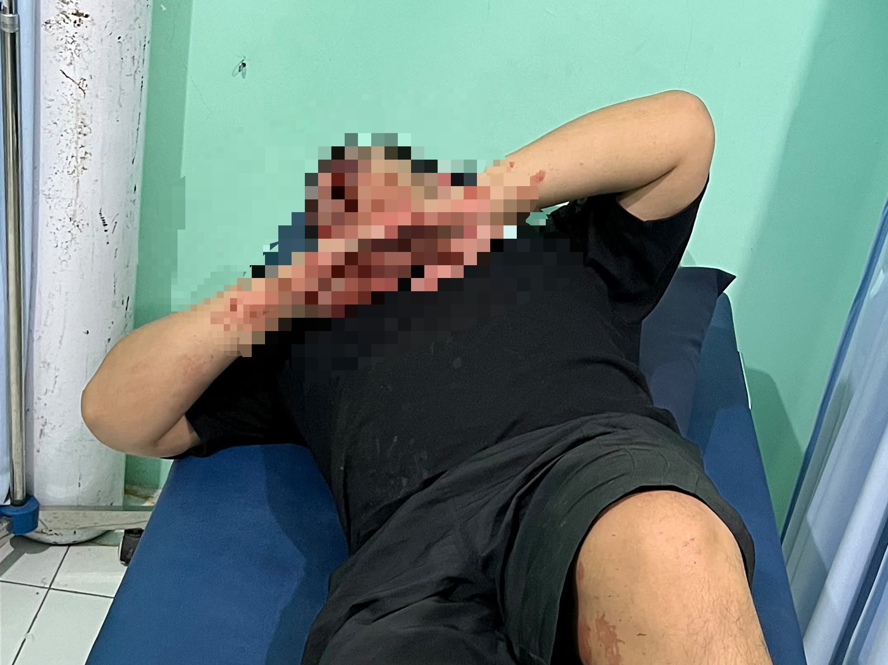 Jadi Korban Pengeroyokan, Pemuda di Gresik Alami Luka-luka